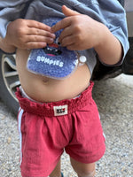 Load image into Gallery viewer, Bumpies Reusable Hot & Cold Pack for Kids - OOPSIE